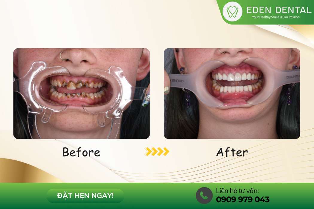 Professional dental care